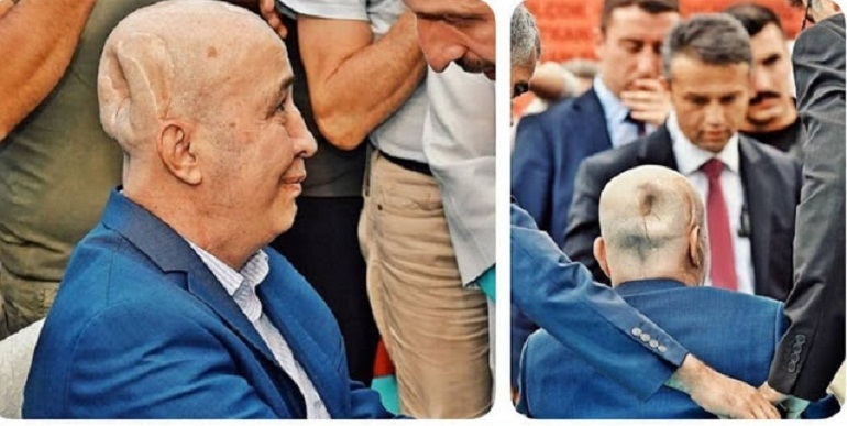 Kisah Lelaki Penyok Penyelamat Kudeta Erdogan